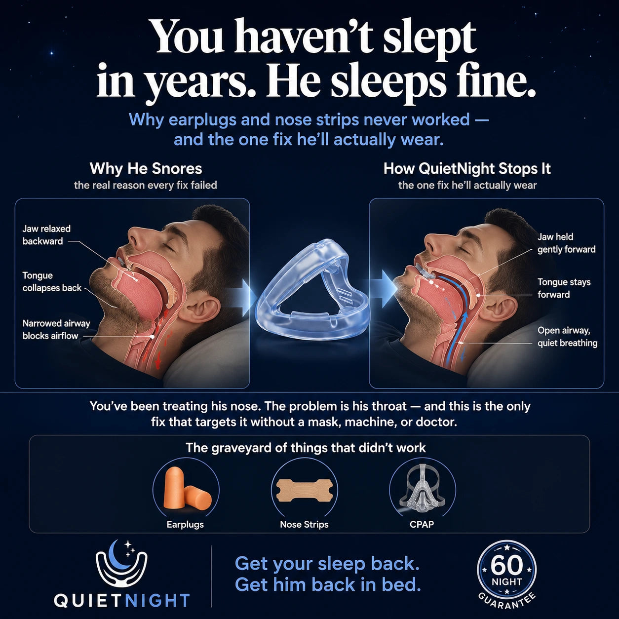 QuietNight™ Anti-Snoring Mouthguard